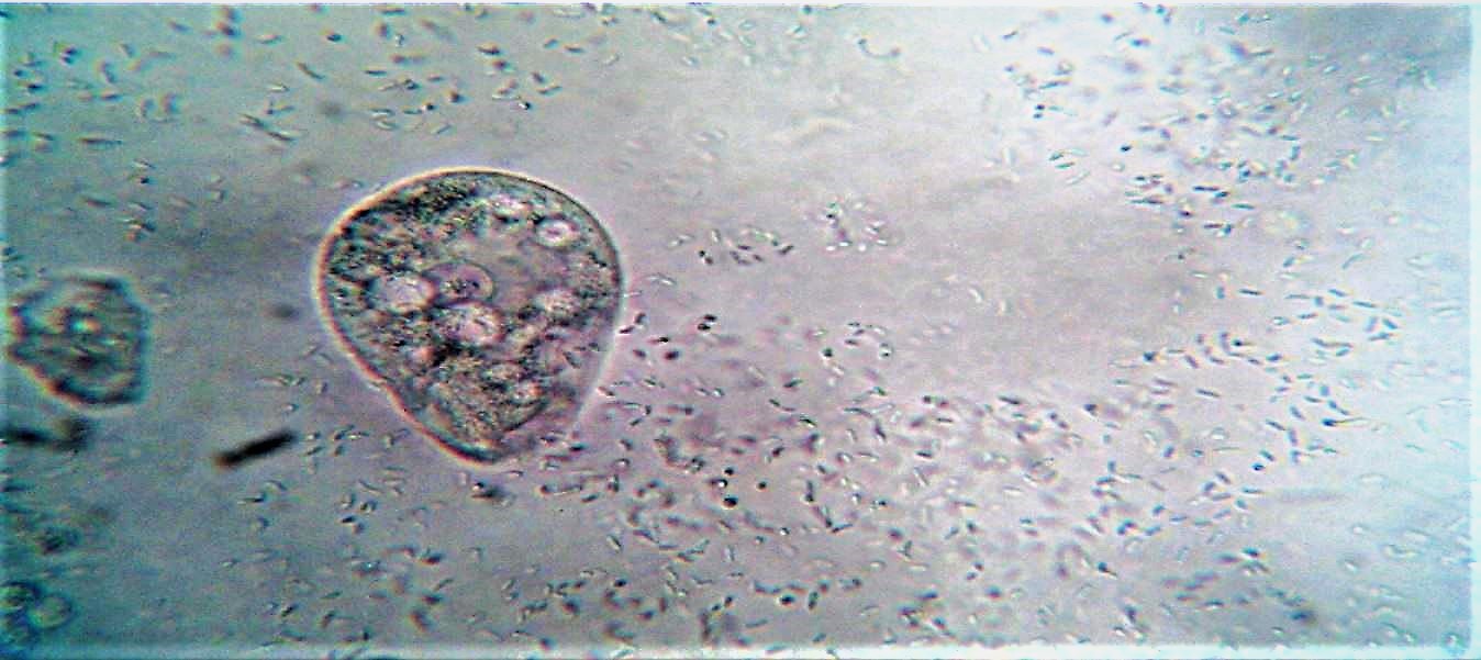 Ciliato da determinare